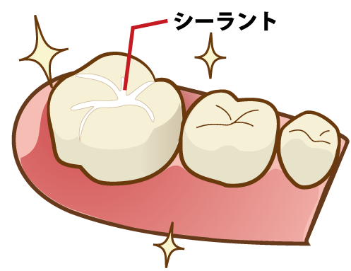 船堀の歯医者で予防歯科